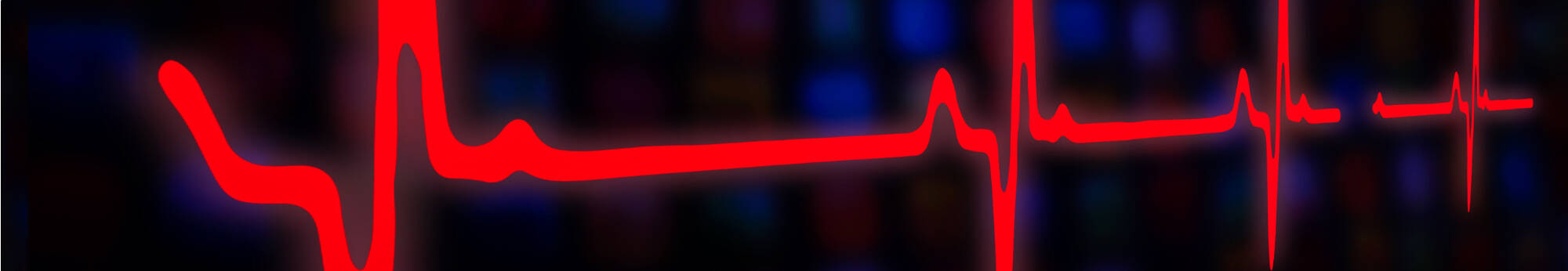 A heart monitor read-out